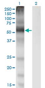 SLC7A1 Monoclonal Antibody (2B9)