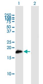 SLC11A1 Polyclonal Antibody, MaxPab™
