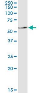 SLC11A1 Monoclonal Antibody (2G2)