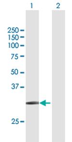 SLC14A1 Polyclonal Antibody, MaxPab™