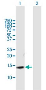 SLPI Antibody in Western Blot (WB)
