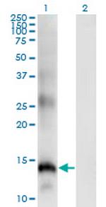 SLPI Monoclonal Antibody (3C6)