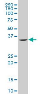 SNAI2 Monoclonal Antibody (6A7)