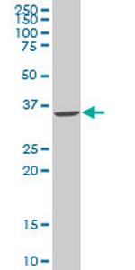 SNAI2 Monoclonal Antibody (2F11)