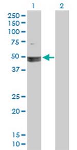 SMARCB1 Antibody in Western Blot (WB)