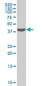 SMARCB1 Monoclonal Antibody (3E3)