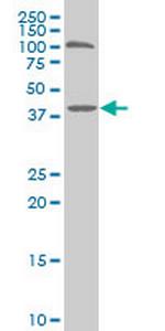 SMARCB1 Antibody in Western Blot (WB)