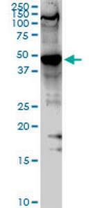 SMARCB1 Antibody in Western Blot (WB)