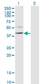 SMARCB1 Antibody in Western Blot (WB)