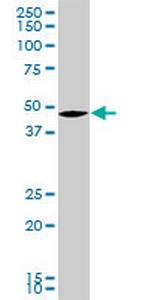 SMARCB1 Monoclonal Antibody (2D10)