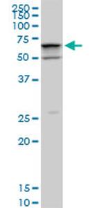 SMARCD2 Antibody in Western Blot (WB)
