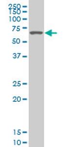 SMARCD2 Antibody in Western Blot (WB)