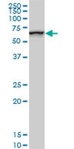 SMARCD2 Antibody in Western Blot (WB)