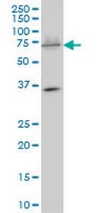 SMARCD3 Monoclonal Antibody (1G6)