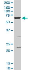 SMARCD3 Monoclonal Antibody (5F12)