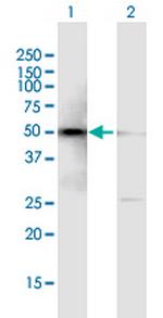 SMARCE1 Polyclonal Antibody, MaxPab™
