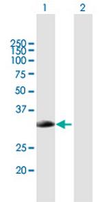 SMN2 Polyclonal Antibody, MaxPab™