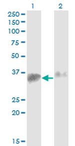 SMN2 Antibody in Western Blot (WB)