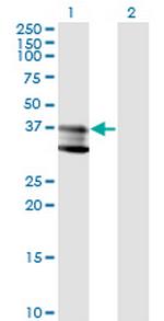 SMPD1 Monoclonal Antibody (4H2)