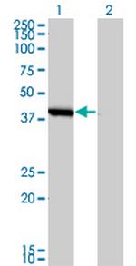 SMS Monoclonal Antibody (1G6)