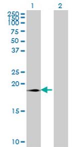 SUMO3 Monoclonal Antibody (4G11)