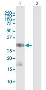 SNAI1 Antibody in Western Blot (WB)