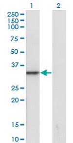 SNAI1 Monoclonal Antibody (1A5)