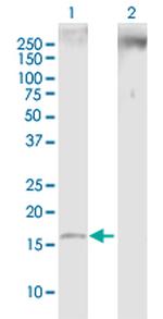 SNCB Polyclonal Antibody, MaxPab™