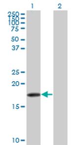 SNCB Monoclonal Antibody (3H4)