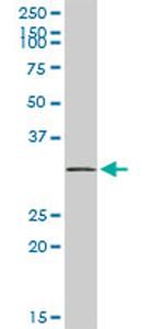 SNRPA Antibody in Western Blot (WB)