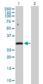 SNRPA Polyclonal Antibody, MaxPab™
