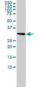SNRPA Monoclonal Antibody (3F9-1F7)