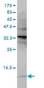 SNRPG Monoclonal Antibody (2H8-1C12)