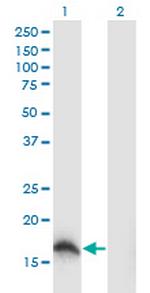SOD1 Monoclonal Antibody (10D5)
