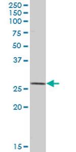 SOD2 Antibody in Western Blot (WB)