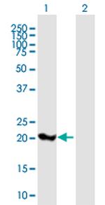 SOD2 Polyclonal Antibody, MaxPab™