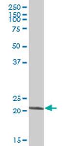 SOD2 Antibody in Western Blot (WB)