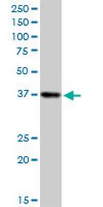 SORD Polyclonal Antibody, MaxPab™
