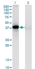 SORD Monoclonal Antibody (1C2)