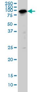 SP1 Monoclonal Antibody (4H6)