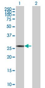SP2 Polyclonal Antibody, MaxPab™