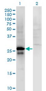 SP2 Monoclonal Antibody (5D3)