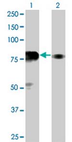 SP100 Monoclonal Antibody (1G6)