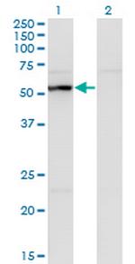 UAP1 Monoclonal Antibody (3A9)