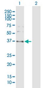 SPARC Antibody in Western Blot (WB)