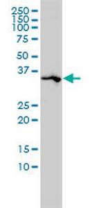 SPARC Monoclonal Antibody (1B2)