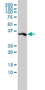 SPARC Antibody in Western Blot (WB)