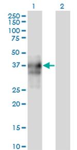 SPARC Antibody in Western Blot (WB)