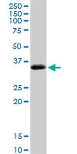 SPARC Antibody in Western Blot (WB)