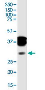 SPI1 Monoclonal Antibody (2G1)
